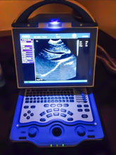 Load image into Gallery viewer, Ultrasound Scanner Prime 56X