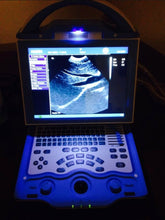 Load image into Gallery viewer, *New* Ultrasound Scanner Prime 56X
