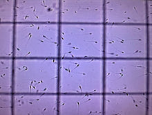 Load image into Gallery viewer, SPERM COUNTING CHAMBER DRM-600 (50CT) CELL-VU DISPOSABLE