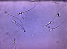 Load image into Gallery viewer, SPERM COUNTING CHAMBER DRM-600 (50CT) CELL-VU DISPOSABLE