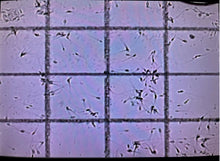 Load image into Gallery viewer, SPERM COUNTING CHAMBER DRM-600 (50CT) CELL-VU DISPOSABLE