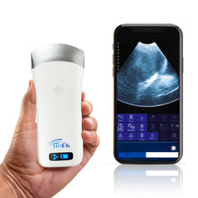 Load image into Gallery viewer, Portable Wireless Ultrasound Scanner-Mobile {Internally Upgraded} (Hoëk Traveler Lite 250)
